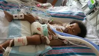 Congenital Vascular Malformation: Baby fights rare disease that's hard to diagnose, treat