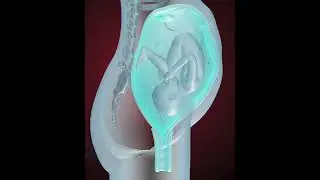 Fetus coming in to birth position (3D Animation)