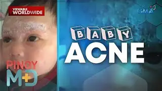 Sanggol, tinubuan ng pimples sa mukha?! | Pinoy MD