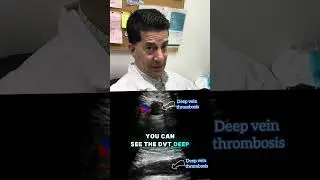 WHAT IS A DVT?