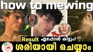 How to Mewing correctly Malayalam| improve jawline 🧏🔥 Hiltapmedia