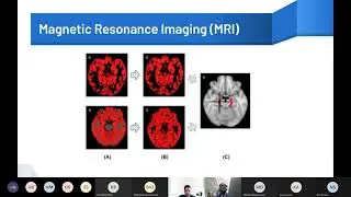 RadCon 2021: Research Methods in Radiology Workshop by Chirag Chopra