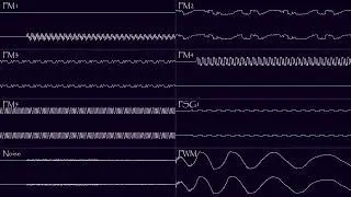 Bliss Hill Zone (Oscilloscope View) - GameTap, Cup Noodles, and Bitter Tears OST