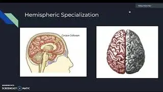 Neuro-Roger Sperry