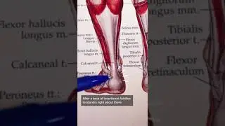 Вставочный ахиллов тендинит