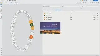* IDDA MiniBytes - How to Scan in MEDIT, Design in EXOCAD then Mill from INLAB 22 *
