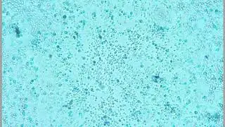 Active Yeast Cells Under the Microscope X40