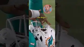 Врач смотрит травмы футболистов NFL