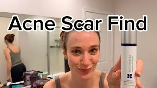 Amazon Review of BIOCORNEUM Silicone Scar Gel with SPF 30 #ad