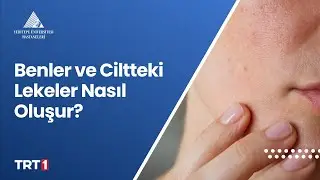 Benler ve Ciltteki Lekeler Nasıl Oluşur?