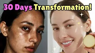 &ldquo;I Used Potato on My Face for 30 Days &ndash; Dark Spots and Hyperpigmentation Faded Naturally!&rdquo;