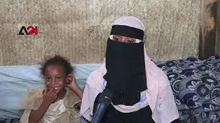اليمن - تفاقم معاناة النازحين في مخيم الرباط جراء قلة المساعدات