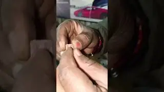 Hyundai i20 ka fuse kaise pata Karen kharab ho chuka hai#automobile🧑&zwj;🔧🧑&zwj;🔧🧑&zwj;🔧✅✅