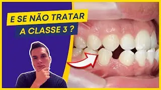 CLASSE 3 DENTÁRIA: O QUE ACONTECE SE NÃO TRATAR?