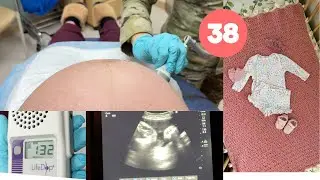 Will they offer a cervical check & a membrane sweep at my 38 week OB appointment?