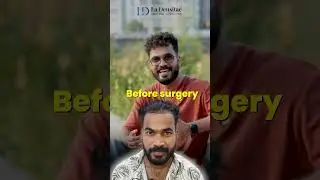 Rj Gaddafi 1 Year Hair Transplantation Reult | Ladensitae Hair Transplant Clinic