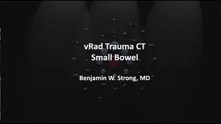 Small Bowel | 10-minute Radiology Case Reviews
