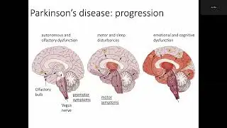 Visiting Lecture: Olfactory Changes & Early Detection of Neurodegenerative Disorders