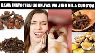 DAWA INAYOTIBU JINO LINALOUMA SANA BILA KUNG'OA HII APA/DAWA ASILI YA MENO KUTOBOKA,KUUMA NA HARUFU