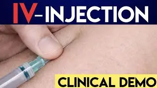IV (Intravenous) Injection Procedure | Educational Medical Demonstration