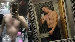 4 Years Body Transformation - Pectus Excavatum (sunken chest)