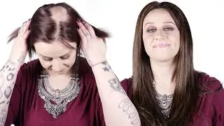 Alopecia Hidden Crown Miracle In Under A Minute! - Hidden Crown
