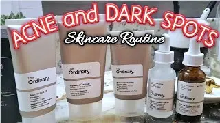Skincare Routine Acne and Dark Spots | The Ordinary Balance Set