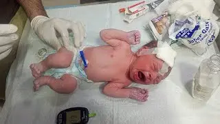 Active Newborn Baby Care | Cleaning Airway, Checking Sugar & Vitamin K