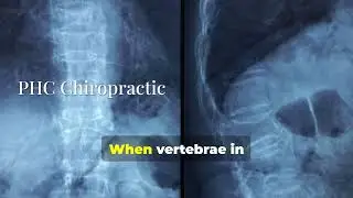 Constipation Due To Back Problems &ndash; Chiropractic Helps | PHC Chiropractic