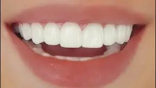 ⚠️ Extreme White teeth instantly ⚠️ | Subliminal