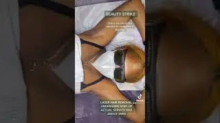 Beauty Strike offers exclusive laser services curated for all skins types 💜