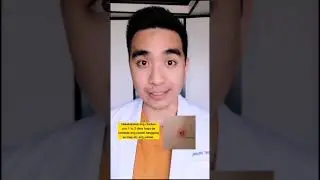 Chickenpox by Dr.Kilimangaru #HealthTokPh