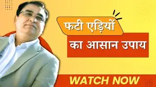 Painful Cracked Heels Treatment | Ayurvedic Remedies | ⁨@VedicUpchar⁩ | Anil Bansal | #remedies