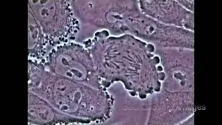 Mitosis in an animal cell Under the Microscope