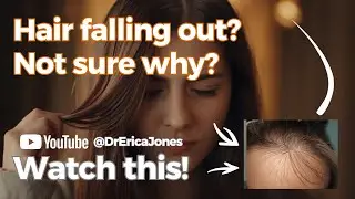 Hair falling out? Watch this to learn about  the Types of Hair Loss