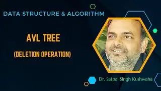 AVL Tree Deletion Operation