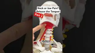 Part 2 - Jaw or Neck Pain? Release Your Tongue! #tmj #neckpain #headache