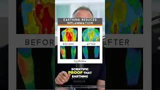 Grounding is key 🔑 | Dr. Gary Brecka #health