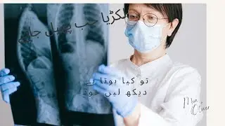 lakri ka kam /wooden work Urdu poetry