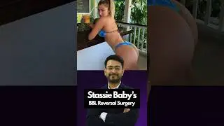 Stassie Baby&rsquo;s BBL Reversal Explained by a Plastic Surgeon | Why the Trend is Changing!  #celebrity