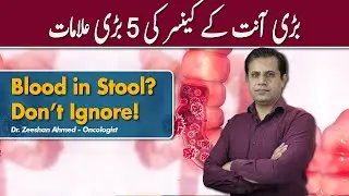 5 Major Signs Of Colon Cancer | 5 Signs Of Colon Cancer Hone Ki
