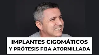↘IMPLANTES CIGOMÁTICOS: Carga Inmediata sin injerto óseo en un día