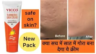 VICCO New Pack Turmeric Skin Cream | Full Review and Demo | DIY & Beauty