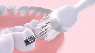 GUM&reg; ORTHO SONIC Toothbrush: Deeper Clean for Braces, Wires & Gum Line
