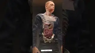 What Really Happens in Appendix Surgery? Full Details!