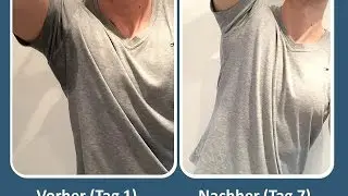 Was tun gegen starkes Schwitzen? Was mir wirklich gegen mein Schwei&szlig;problem geholfen hat!