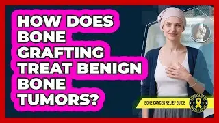 How Does Bone Grafting Treat Benign Bone Tumors? - Bone Cancer Relief Guide