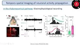 OHBM 2023 | 2814 | Symposium | Jang-Yeon Park | In vivo direct imaging of neuronal activity at hig&hellip;