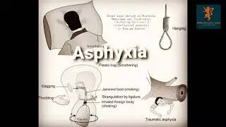 Asphyxia part 2 podcast || Forensic Medicine|| 3rd year