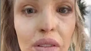 Katie Piper's Inspiring Acid Attack Recovery | New Era of Confidence